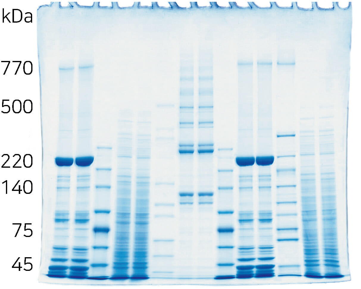 Electrophoresis pattern of U-PAGEL H (3~10%)