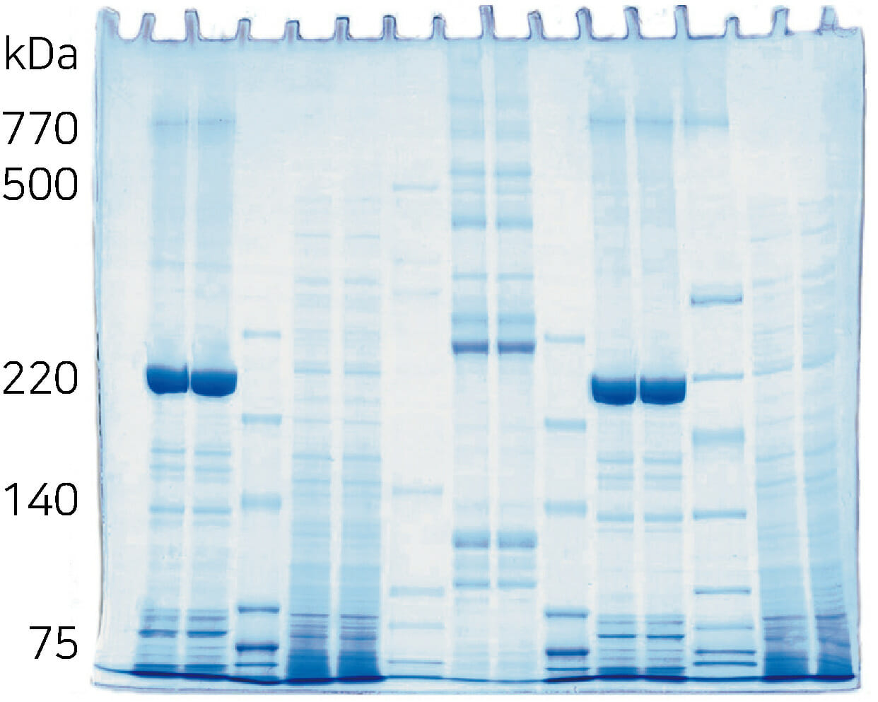 Electrophoresis pattern of U-PAGEL H (5%)